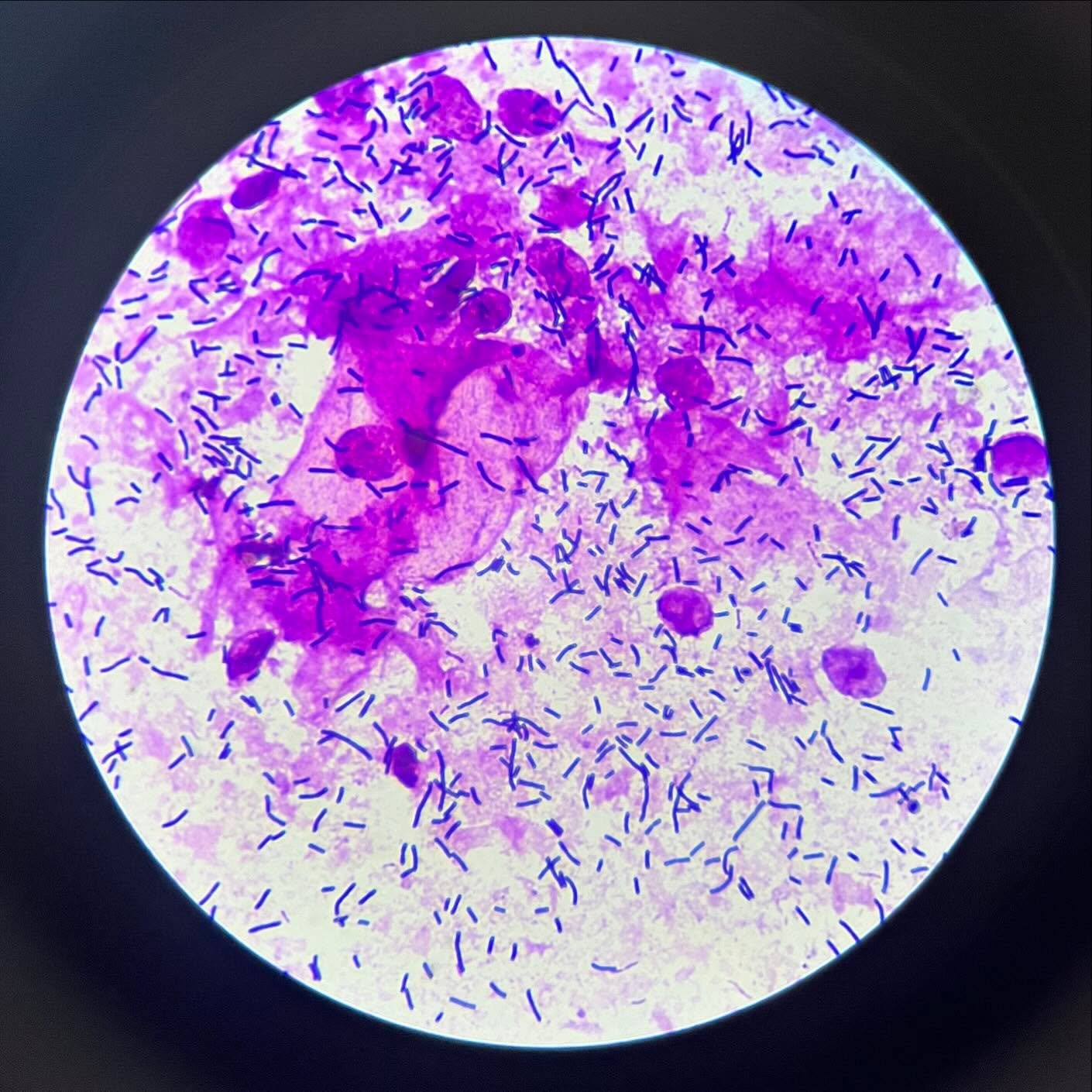 Microscópio utilizado na análise do conteúdo vaginal